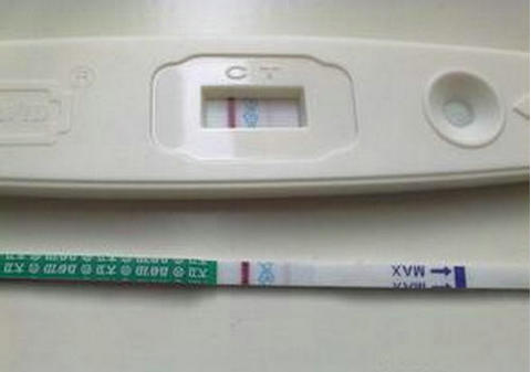 妇科微创